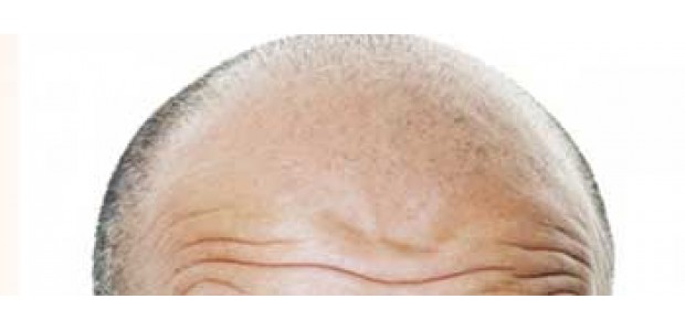 شایع ترن علل ریزش مو در مردان و زنان چیست؟
