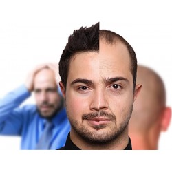 درباره ریزش موی مردان اینجا مطالعه کنید